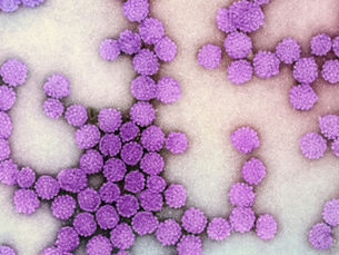 Cervical cancer elimination possible if we choose equity
