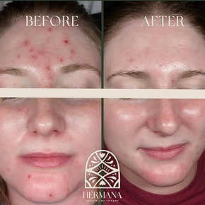 Copy of Instagram before + after (2).png