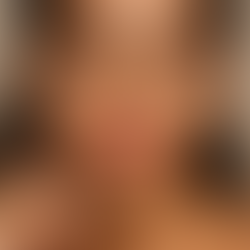 Close-up de mulher com lábios volumosos, hidratados e maquiagem leve, destacando uma pele uniforme e saudável.