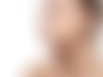 What Jawline filler means in facial contour analysis