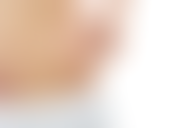 How Does Laser Liposuction Compare to Traditional Methods?