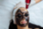 Close-up of cosmetologist's hand making hardware carbon peeling by young pretty customer w