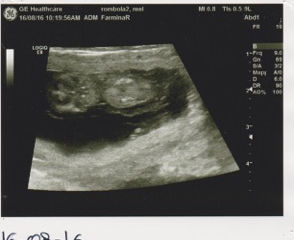 32 giorni di gestazione