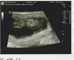 32 giorni di gestazione
