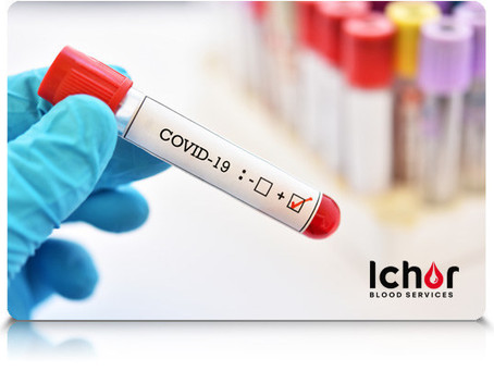 Asymptomatic saliva-based COVID-19 PCR testing available at DrugSmart Pharmacy
