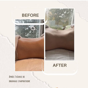 Avant/après une séance drainage lymphatique Renata França
