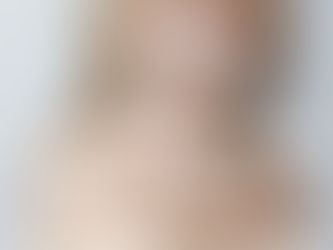 Dentista Viña del Mar: Implantes Dentales y Alineadores Fabricados en Clínica