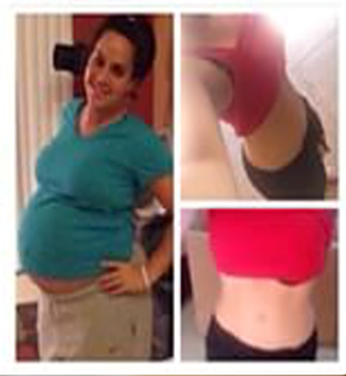 Lost My Baby Bump!