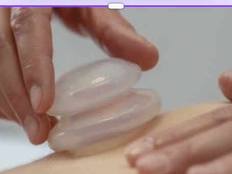 Gentle Silicone Cupping for Scar and Tissue Mobility: What You Need to Know