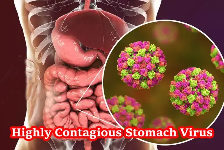 Highly Contagious Stomach Virus Spreading