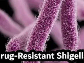 Drug-Resistant Shigella Cases Rising What to Know About the Dangerous Diarrheal Infection