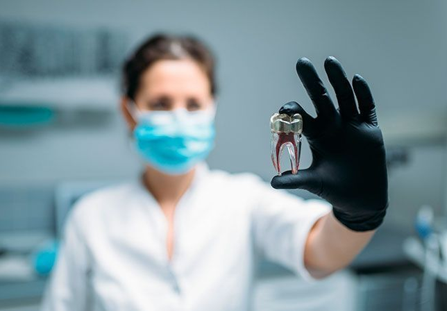 Exodoncia dental: Cuándo es necesaria?