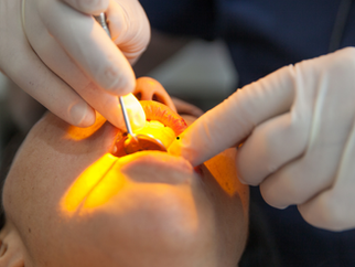 Oral surgeon examining a patient's teeth under a bright examination light using dental tools, wearing white gloves.