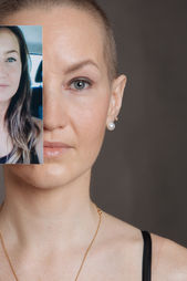 Photographie thérapeutique pour le combat contre le cancer