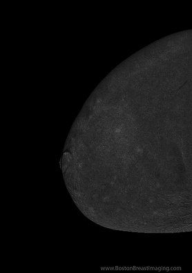 le rcc pre_edited.jpg