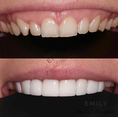 WOW MSM before and after.jfif