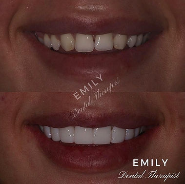 WOW MSM before and after 5.jfif