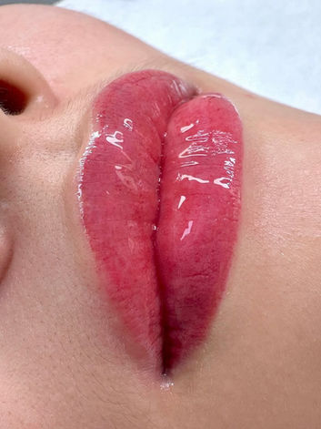 Lip blush cosmetic tattoo in North Sydney showcasing enhanced lip colour, improved definition, and a soft, natural tint for a fresh and youthful appearance.