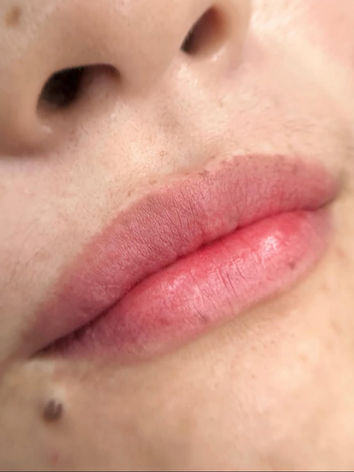 Lip blush cosmetic tattoo in North Sydney showcasing enhanced lip colour, improved definition, and a soft, natural tint for a fresh and youthful appearance.