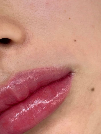 Lip blush cosmetic tattoo in North Sydney enhancing lip colour, symmetry, and definition with a soft, natural-looking result.