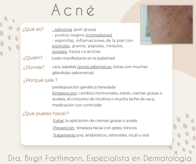 Acné 