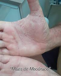 Imagem retirada da internet - mãos de mecânico característica da SAS