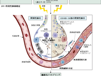 No.281 コロナ後遺症:肺および肺以外の症状