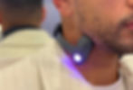 Vagus Nerve Stimulation