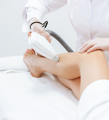 laser hair removal