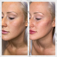 Cheeks-use--1024x1024.png