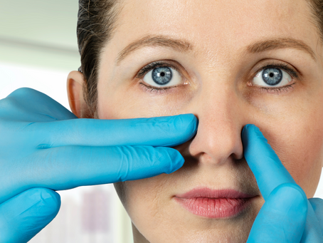 RINOPLASTIA