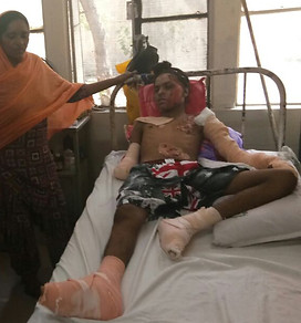 2017 Gurpreet Singh Before.jpg