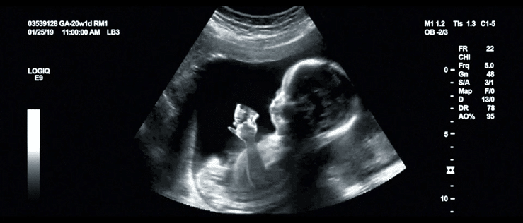 E_TRADE_Born-with-it-high