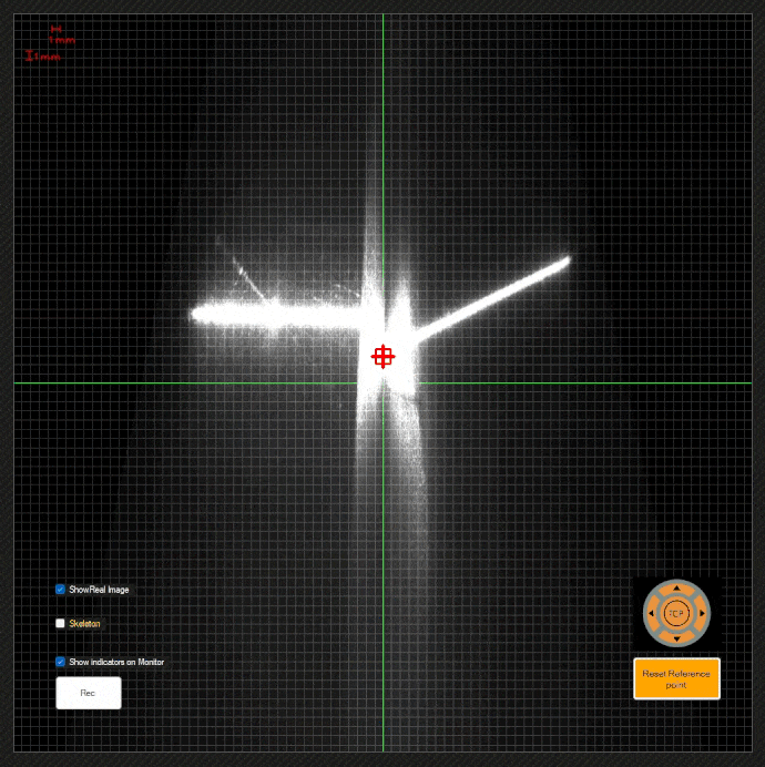 EasyPath Software Overcomes reflections with machine learning