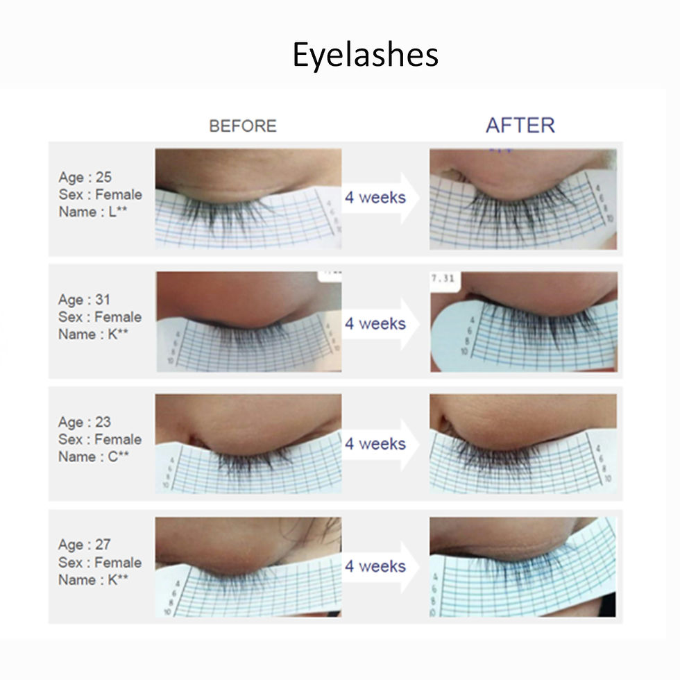 Thumbnail: Dr. Zonskin NUNSSUP JARA+ Eyebrow & Eyelash Serum