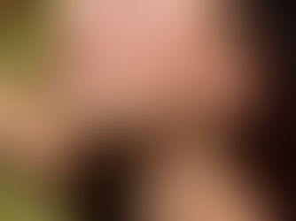 Woman with clear, even skin after sun damage treatment at Horizon Med Spa in Kansas City