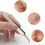 Thumbnail: Acne Needle Blackhead Remover Pimple Blemish Comedone Extractor Tweezer Tool Kit