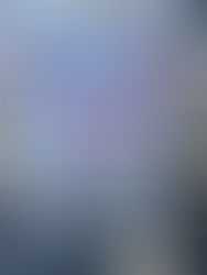 Treatment NOT Tents- Prop 1 to Prop F