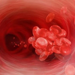 Trombose venosa é uma doença que pode matar, mas é possível prevenir.