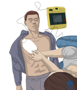 13_SBVD_Compressões