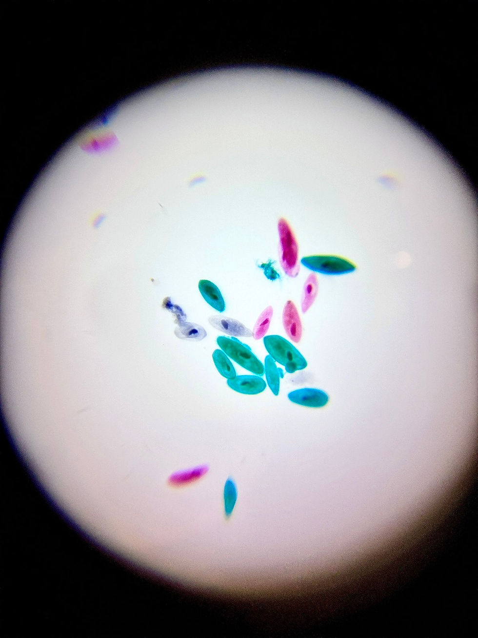 paramecium