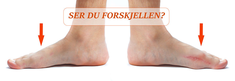 To føtter blir sammenlignet med tekst "SER DU FORSKJELLEN?" i midten, og røde piler peker nedover mot hver fot.
