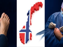 Hallux Valgus-operasjon når du bor i Oslo, Trondheim, Stavanger eller Nord-Norge: Slik fungerer forløpet