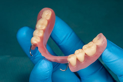 partial denture