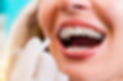 orthodontics