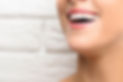 dental whitening
