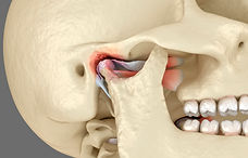 tmj articulation