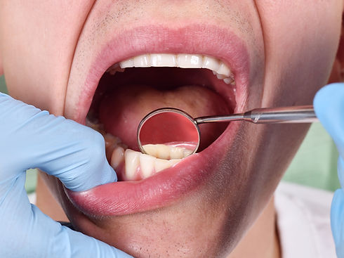 periodontal exam