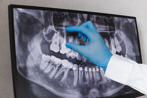 x-ray