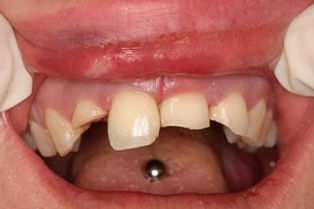 Piercing4.jpg